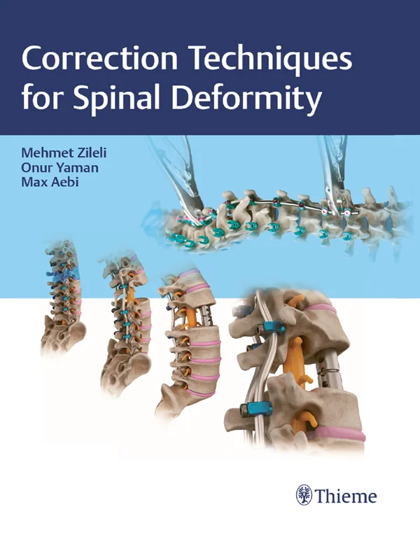جلد تکنیک‌های اصلاح بدشکلی ستون فقرات ۲۰۲۴  Correction Techniques for Spinal Deformity 2024