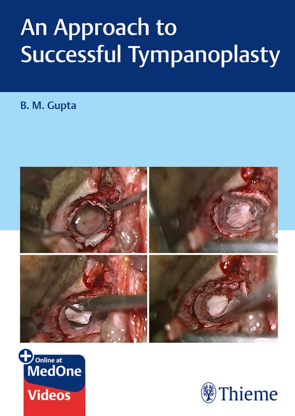 جلد رویکردی به تمپانوپلاستی موفق ۲۰۲۴  An Approach to Successful Tympanoplasty 2024