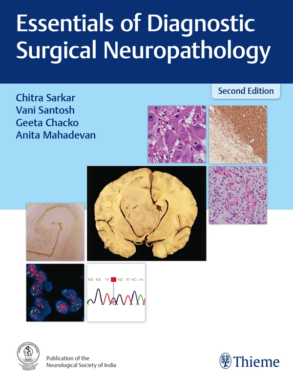 جلد مبانی نوروپاتولوژی جراحی تشخیصی ۲۰۲۴  Essentials of Diagnostic Surgical Neuropathology 2024